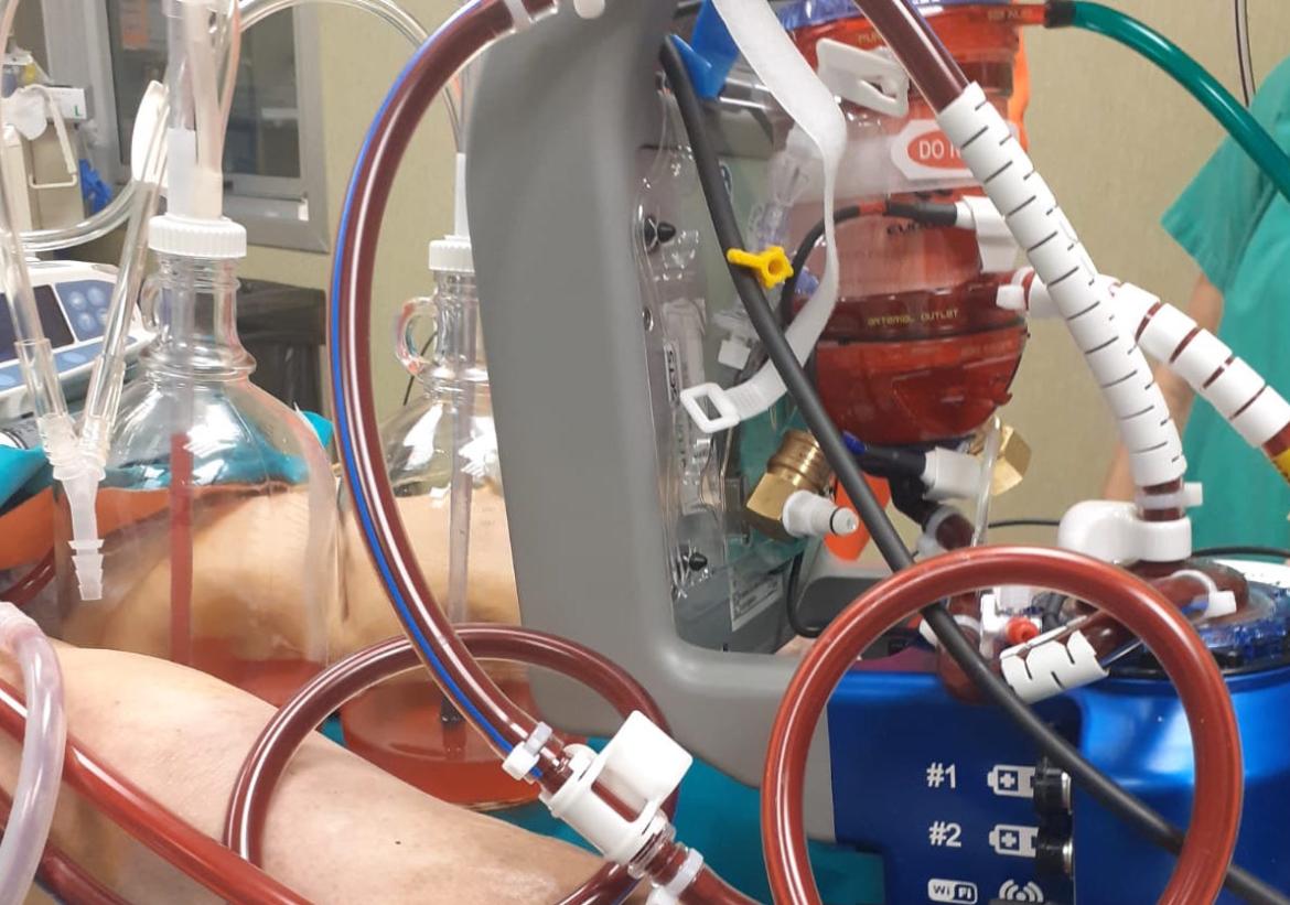 Primo intervento italiano dell’Ecmo portatile. L’analisi del direttore di Rianimazione