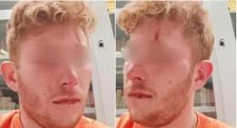 Studente 22enne aggredito in Università a Pavia: «Picchiato perché di destra»