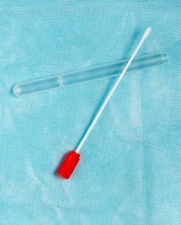 Screening Hpv con autoprelievo: dopo due anni e mezzo ancora si attende