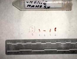 I dubbi sull’analisi del Dna nel 2017: il genetista Giardina segnalò «criticità» e limiti dell’attribuzione